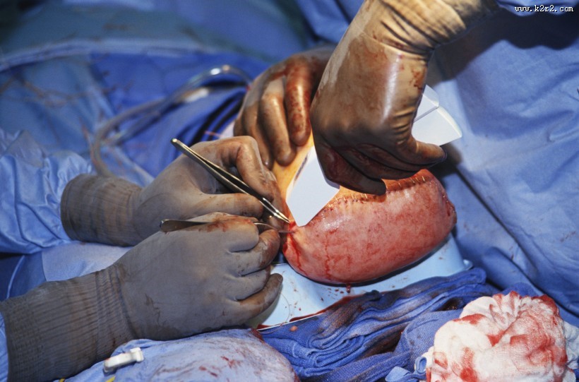 手术台上的医护人员图片大全