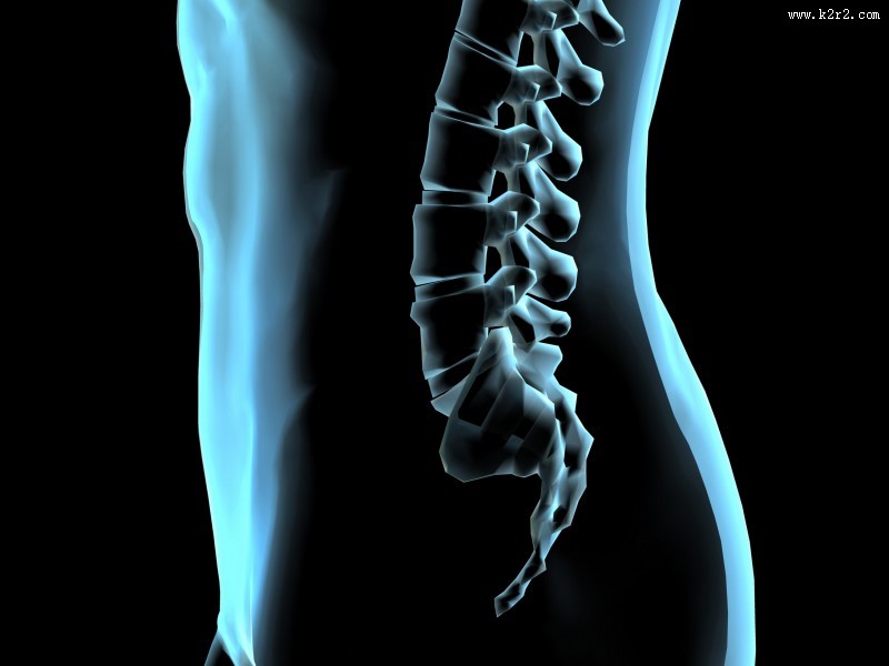 人体x光片图片大全