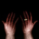 X光下的人物图片大全