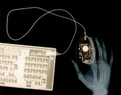 X光下的人物图片大全