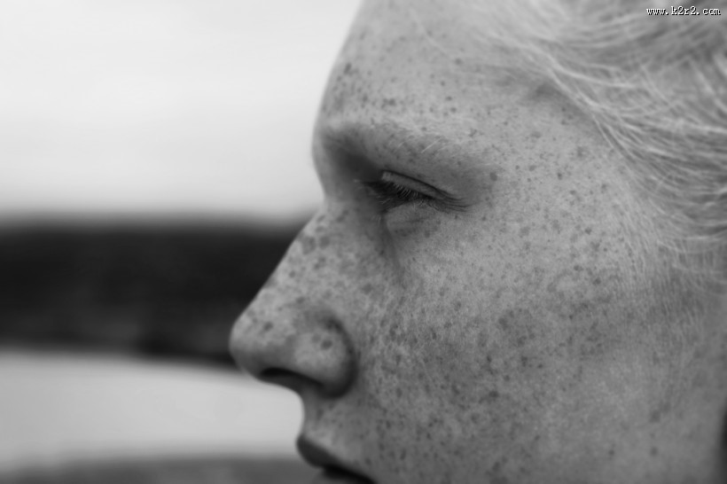 脸上有雀斑的女孩黑白图片