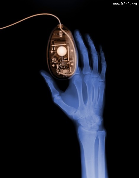 X光下的人物图片大全