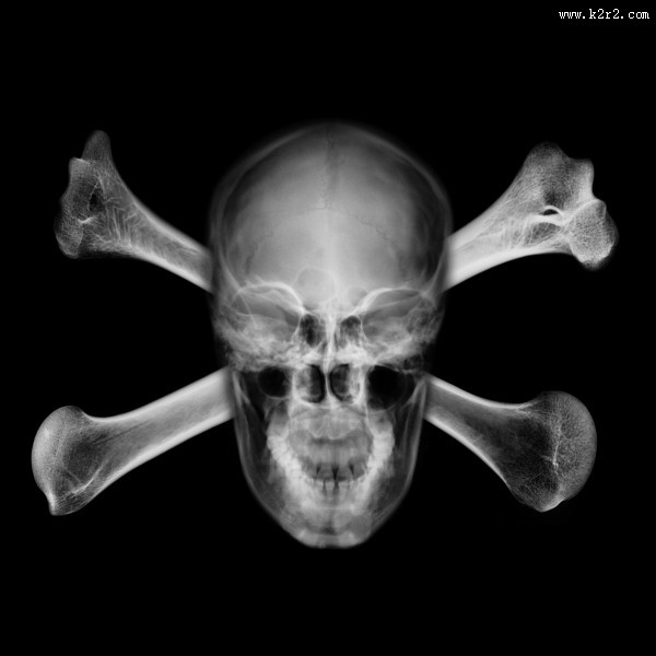 X光下的人物图片大全