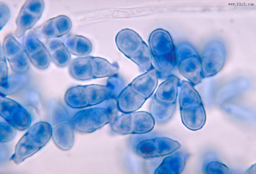 显微镜下的细菌图片大全