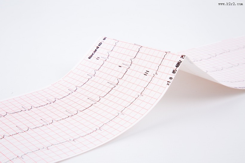 心电图图片大全