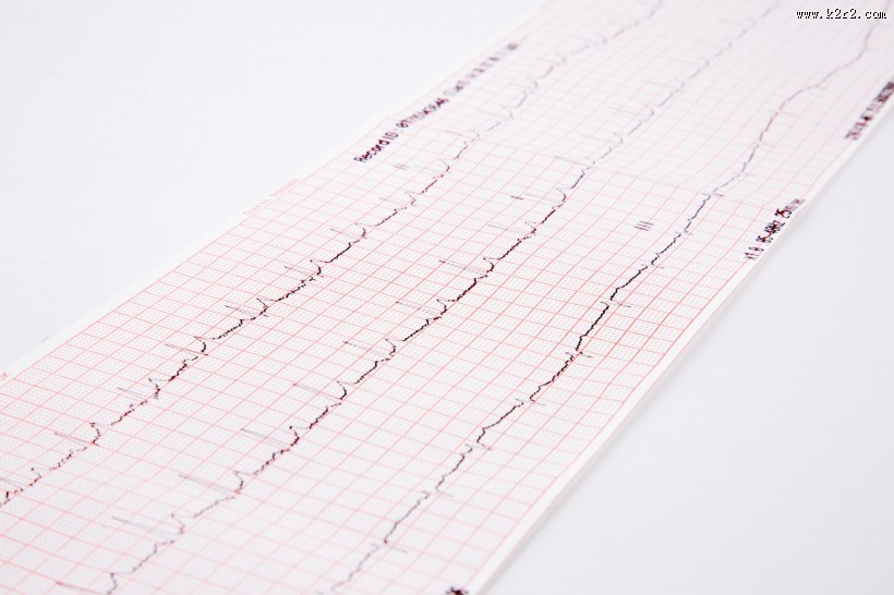 心电图图片大全